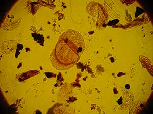 Mikroflora in Sedimenten